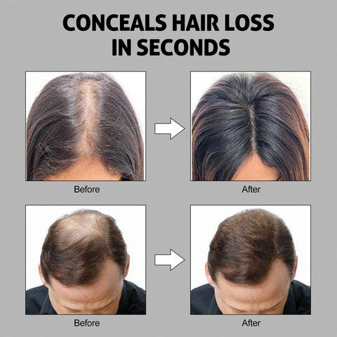 Ustar Hair Building Fibers and Hair Loss Concealers .42oz/12g for Thinning Hair - Buy One Get One 50% Off